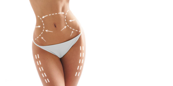 Liposuktion Moers